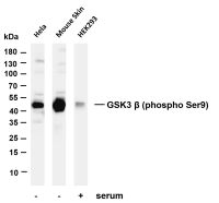 GSK3 β (Phospho Ser9) (PT0078R) PT® Rabbit mAb
