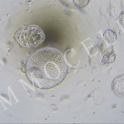 hPSC来源诱导分化肝类器官iHHOs-H1