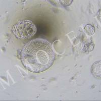 hPSC来源诱导分化肝类器官iHHOs-H1