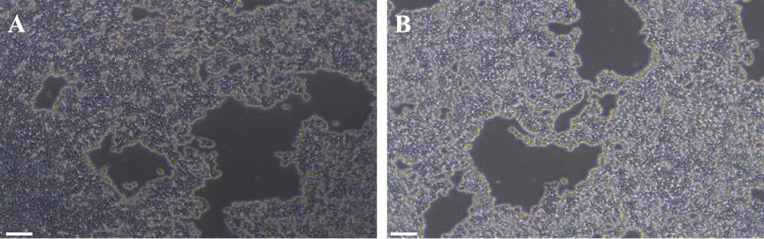 hESC/iPSC 传代工作液(无酶)