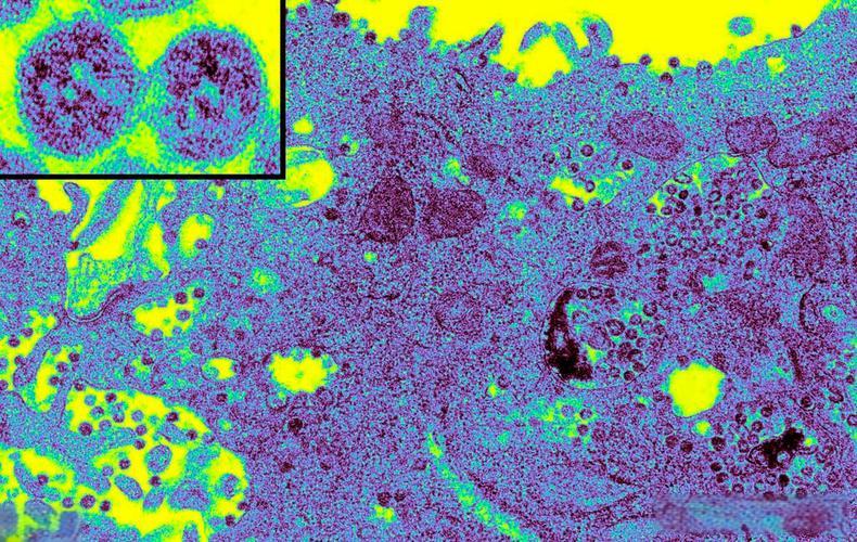 犬冠状病毒蛋白；犬冠状病毒（CCV）-S蛋白；犬冠状病毒（C