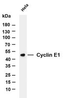 Cyclin E1 (PT0164R) PT® Rabbit mAb