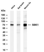 S6K1 (PT0095R) PT® Rabbit mAb