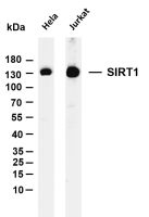 SIRT1 (PT0158R) PT® Rabbit mAb
