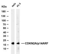 Histone H3 (Phospho Thr3) (PT0291R) PT® Rabbit mAb