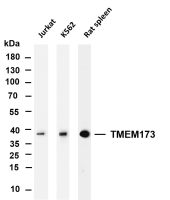 TMEM173 (PT0135R) PT® Rabbit mAb