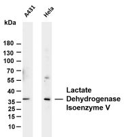 Lactate Dehydrogenase Isoenzyme V (PT0096R) PT® Rabbit mAb