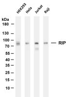 RIP (PT0147R) PT® Rabbit mAb