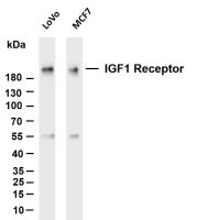 IGF1 Receptor (PT0136R) PT® Rabbit mAb