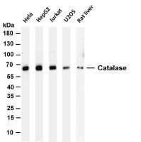 Catalase (PT0146R) PT® Rabbit mAb
