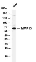 MMP13 (PT0161R) PT® Rabbit mAb