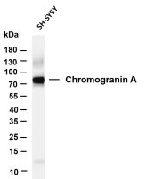 Chromogranin A (PT0092R) PT® Rabbit mAb