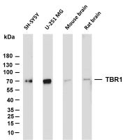MECP2 (PT0726R) PT® Rabbit mAb
