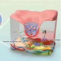 壳聚糖-甘油磷酸钠（CGP）水凝胶包载庆大霉素