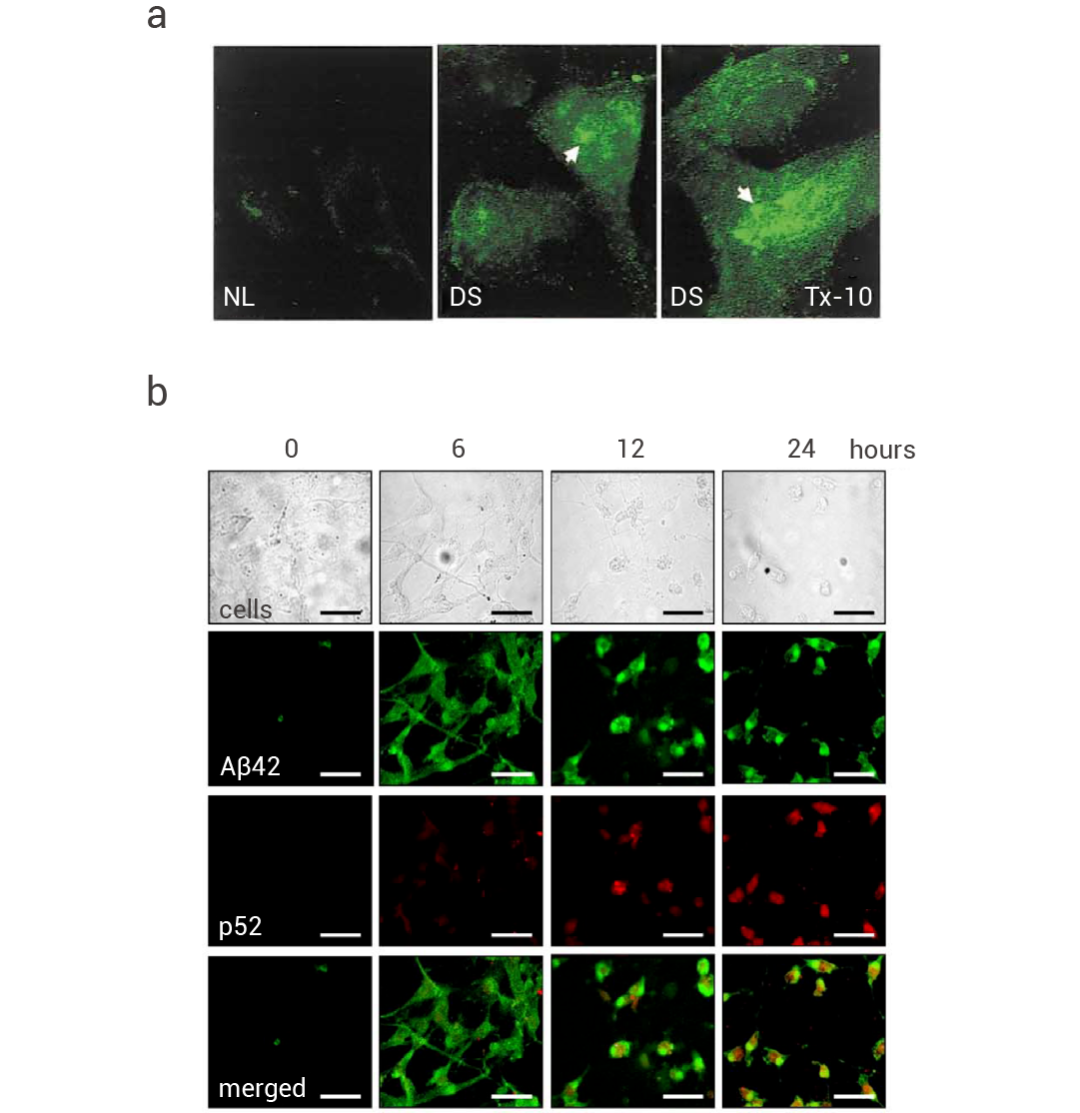 阿爾茨海默癥: 關(guān)于 “β-淀粉樣蛋白“ 的 7 大常見檢測(cè)！