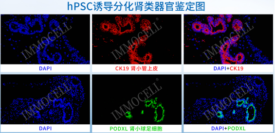 hPSC诱导分化肾类器官试剂盒