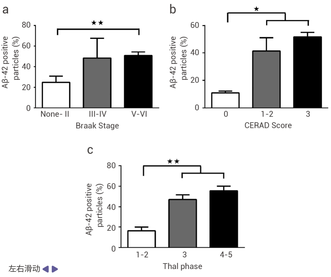 阿爾茨海默癥: 關(guān)于 “β-淀粉樣蛋白“ 的 7 大常見檢測(cè)！