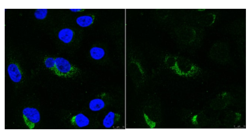Sigma货号MABE1134抗-dsRNA抗体(克隆rJ2