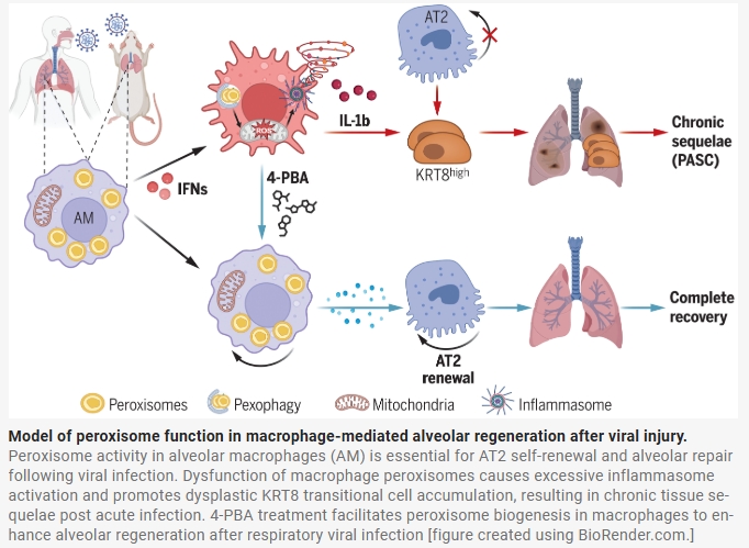 Science：靶向肺泡巨噬细胞的过氧化物酶体有望治疗新冠病毒等呼吸道病毒感染引起的肺部问题