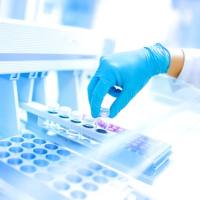 食品中丙烯、酰胺含量检测