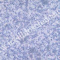 ChaGo-K-1 人肺癌细胞/STR鉴定/镜像绮点（Cellverse）