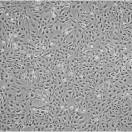  默克Merck LX-2 Human Hepatic Stellate Cell Line