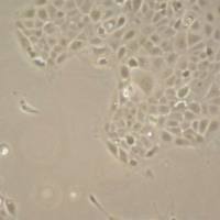 默克Merck UM-SCC-47 HPV-16 Positive Squamous Carcinoma Cell Line
