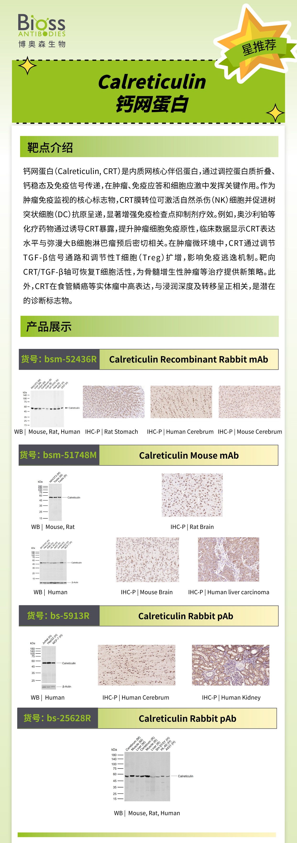 Bioss 星推荐 | Calreticulin