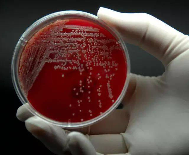 各种微生物接种方法优缺点汇总