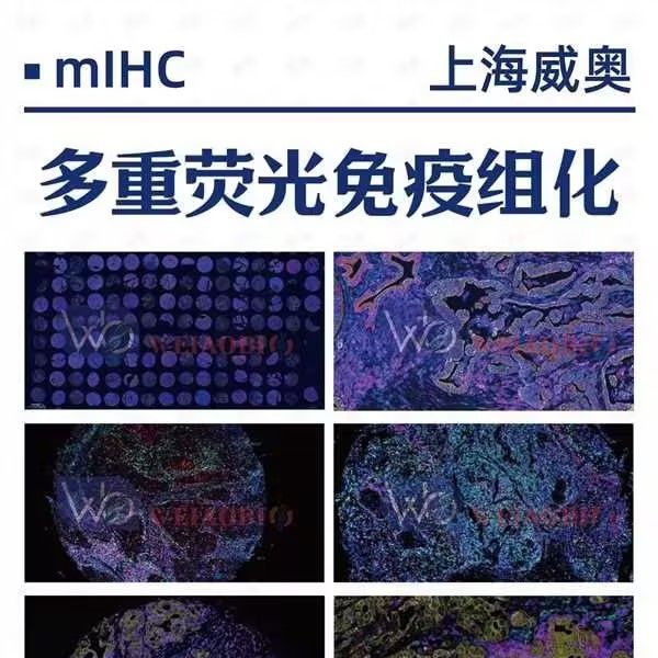 多重荧光免疫组化(mIHC)