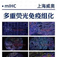 多重荧光免疫组化(mIHC)