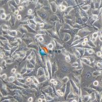 BT-549-GFP+LUC人乳腺管癌细胞-绿色标记+荧光素标记