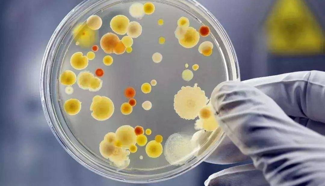 菌落总数平板计数原则与计数准确性的关键