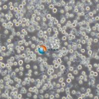 Raji-GFP+LUC人Burkitt's淋巴瘤细胞-绿色标记+荧光素酶标记