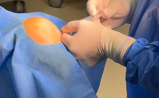 爱萨尔生物干细胞治疗膝骨关节炎项目落地海南博鳌乐城，开启临床应用新篇章——以创新技术赋能医疗普惠，破解传统治疗困境