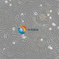 SK-OV-3-GFP人卵巢腺瘤细胞-绿色标记