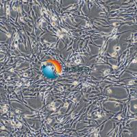 HCCLM3-LUC人肝癌细胞(高转)-荧光素酶标记