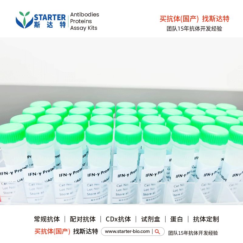 UBE3A His&Flag Tag Protein，Human【中文名称：UBE3A His&Flag 标记蛋白，Human 】