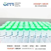 Biotinylated IL-1RAcP/IL-1R3 His&Avi Tag Protein，Human【中文名称：生物素化 IL-1RAcP/IL-1R3 His&Avi 标记蛋白，Human 】