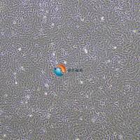 U-87 MG-LUC人脑星形胶质母细胞瘤-荧光素酶标记