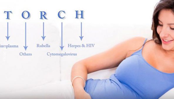 ToRCH筛查共识及试剂研发原料筛选方案