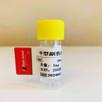 甲型副伤寒单克隆抗体；乙型副伤寒抗体；丙型副伤寒抗体；S-A-McAb