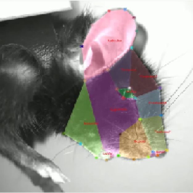 面部疼痛分析系统TOP-Pain