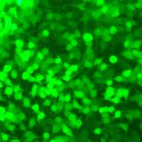 SGC-7901-GFPGFP标记的人胃腺癌细胞