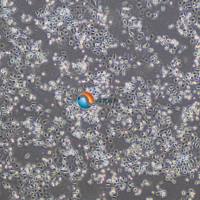 AGS/DDP人胃腺癌细胞顺铂耐药株