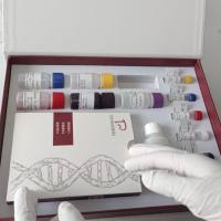 Avian Infectious Bronchitis Virus(AIBV)禽传染性支气管炎病毒Conn型探针法荧光定量RT-PCR试剂盒