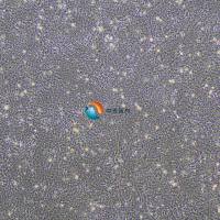 4T1-luc小鼠乳腺癌细胞-荧光素酶标记   