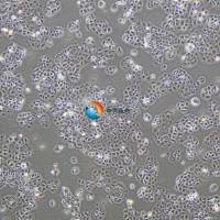 SW 780 [SW-780, SW780]-LUC人膀胱移行细胞癌-荧光素酶标记