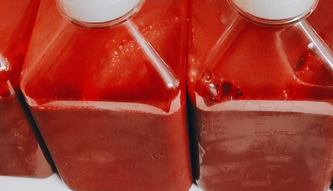 【不同样本区别】全血、血清、血浆详解