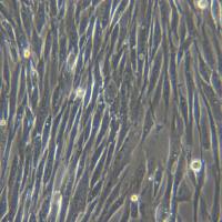 HSGMCs[Human sweat gland myoepithelial cells]人汗腺肌上皮细胞